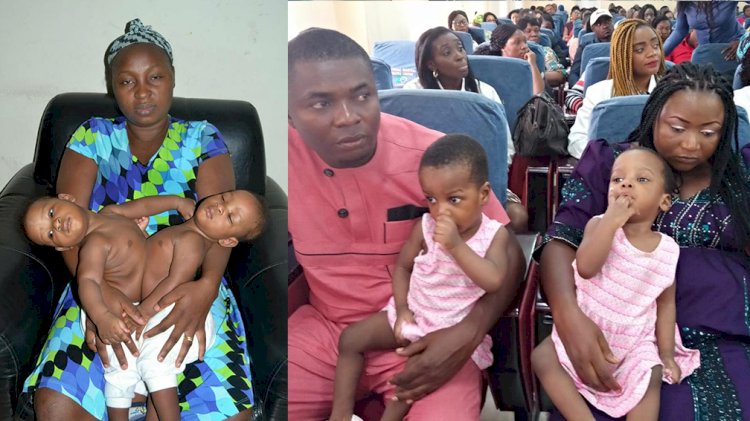 Nigerian conjoined twins successfully separated by 78-member team in Abuja